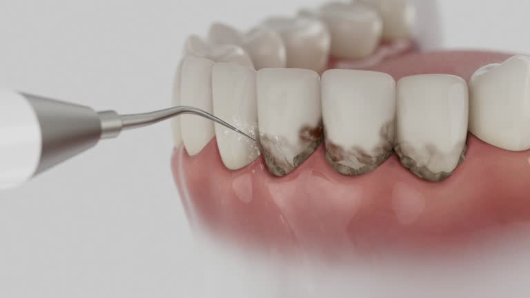 Trusted Teeth Cleaning And Checkup service in Eastern Goleta Valley, CA - Dentist Open Now